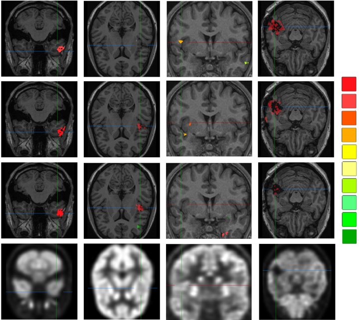 Figure from GAN-based synthetic FDG PET images fr...