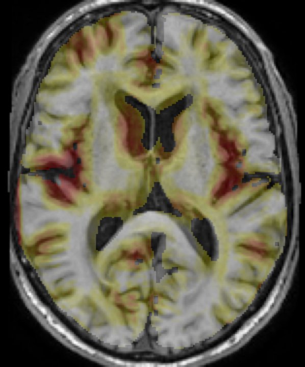 Figure from OCSVM-Guided Representation Learning ...